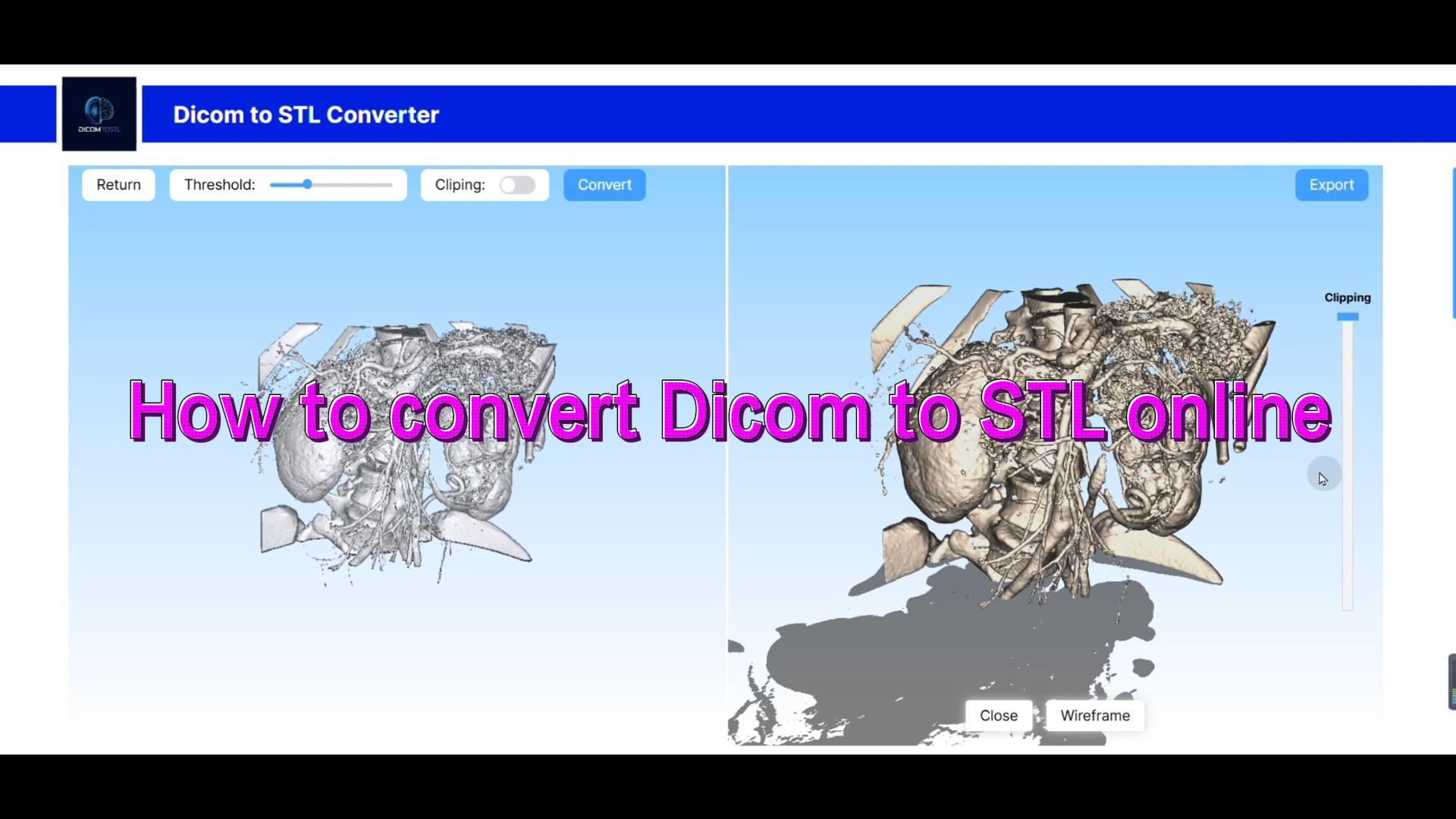 Dicom에서 stl로 - dicom에서 stl로 미디어 2